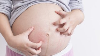 5 myths about pregnancy-related genetic testing and counseling