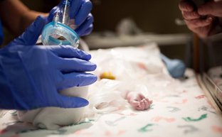 Gloved hands provide oxygen to newborn Valor.