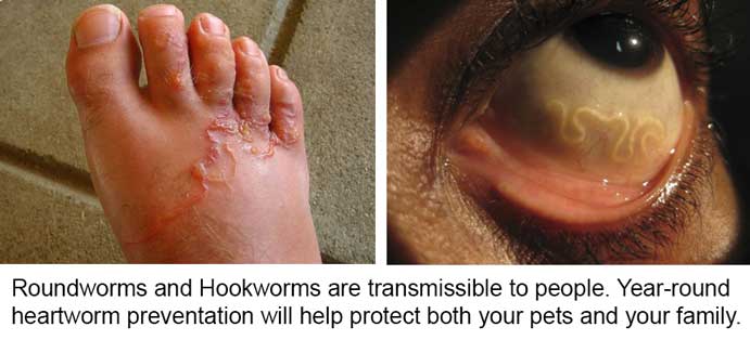 Heartworms In Humans