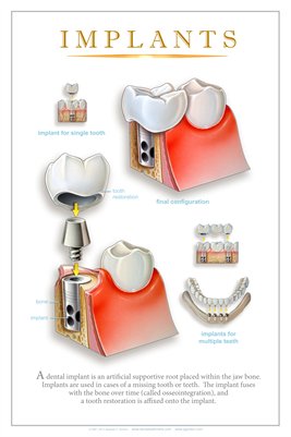 Collection Dental Wall Charts | MagCloud