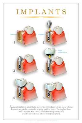 Collection Dental Wall Charts | MagCloud