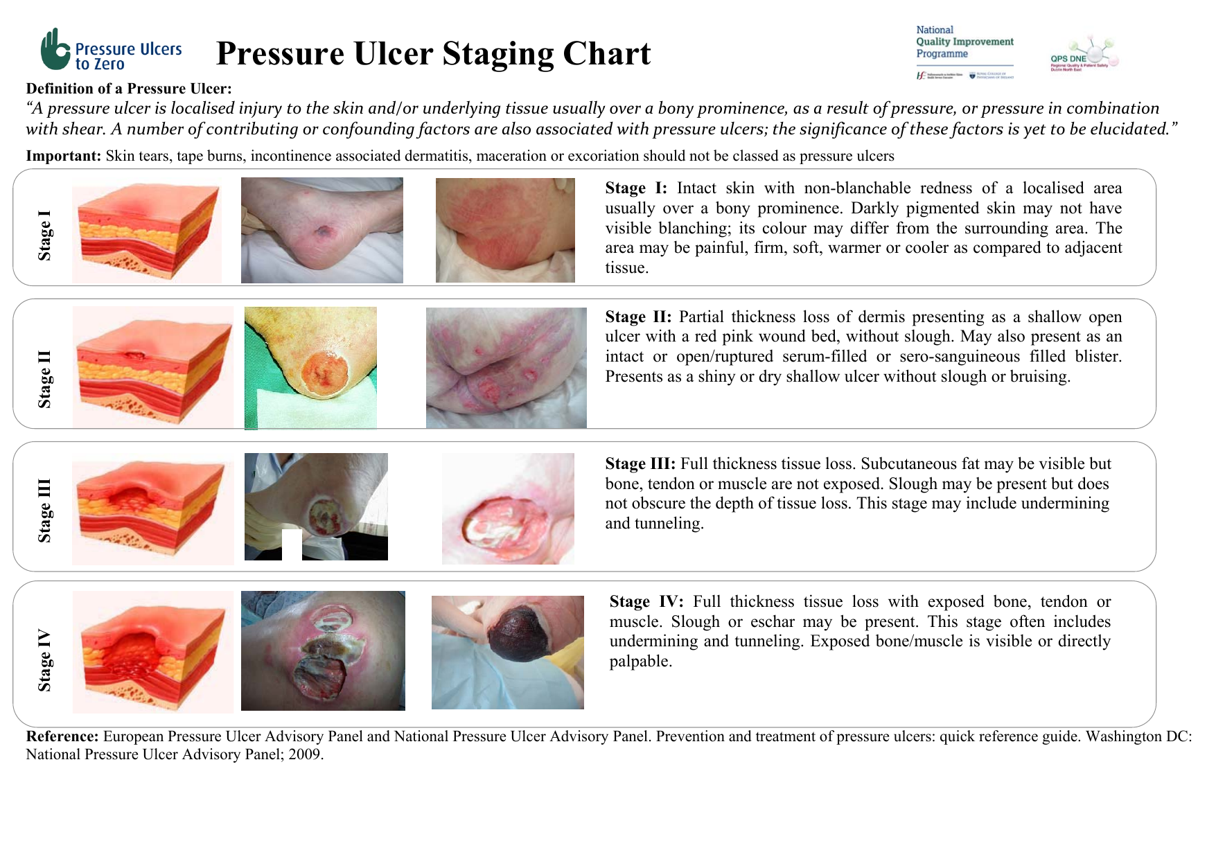 Pressure Ulcers What Are They Sore Skin Pressure Ulce - vrogue.co