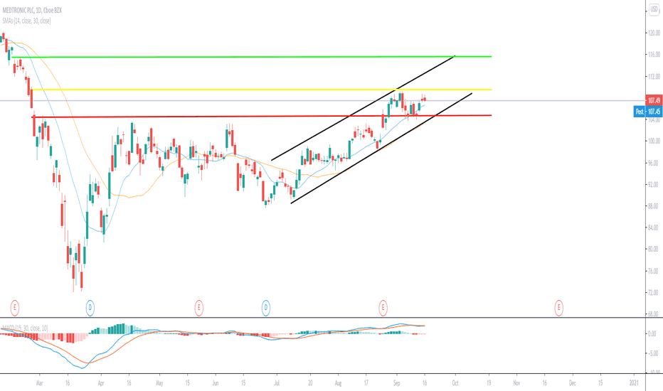 MDT Stock Price and Chart — NYSE:MDT — TradingView