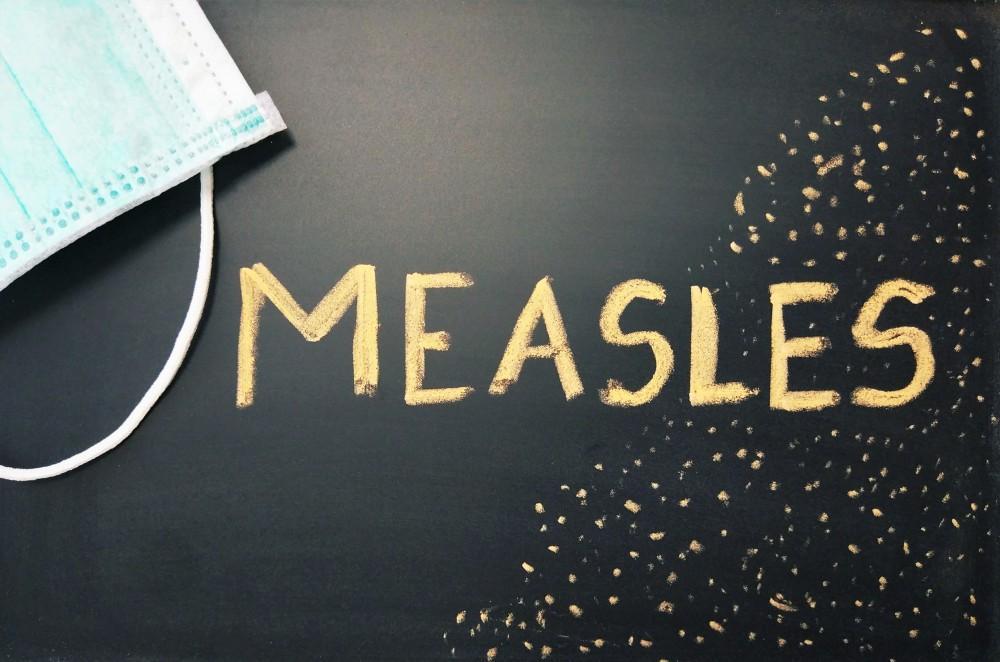 Measles