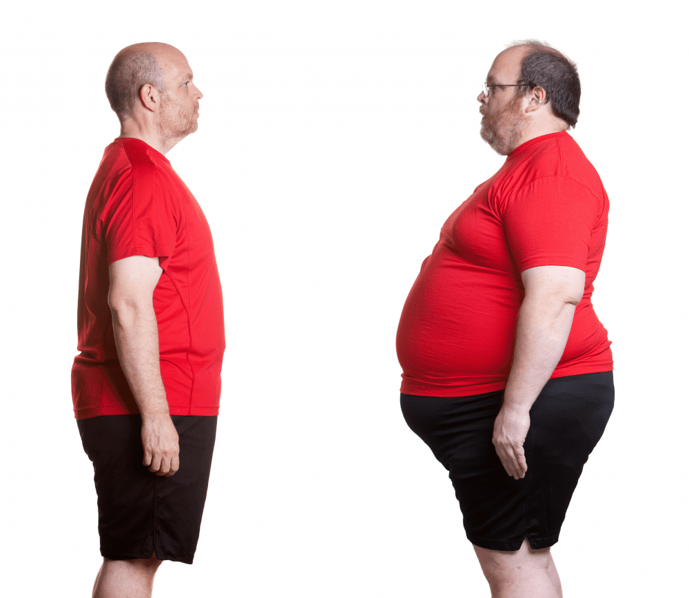 Obesity and Weight Loss