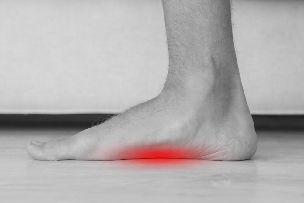 4 Essential Tips for Managing Flat Foot Pain