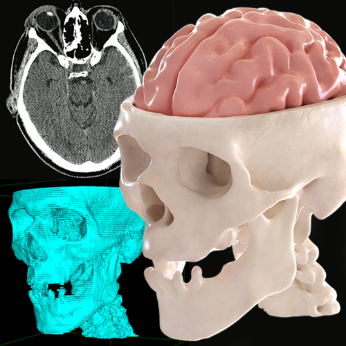 3D Models From Patient Data