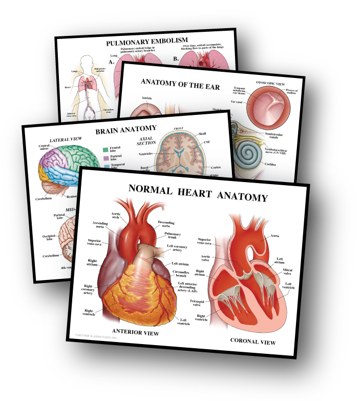 Stock Medical Legal Illustration Exhibits