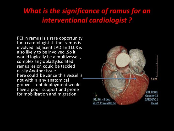 ramus coronary artery diagram