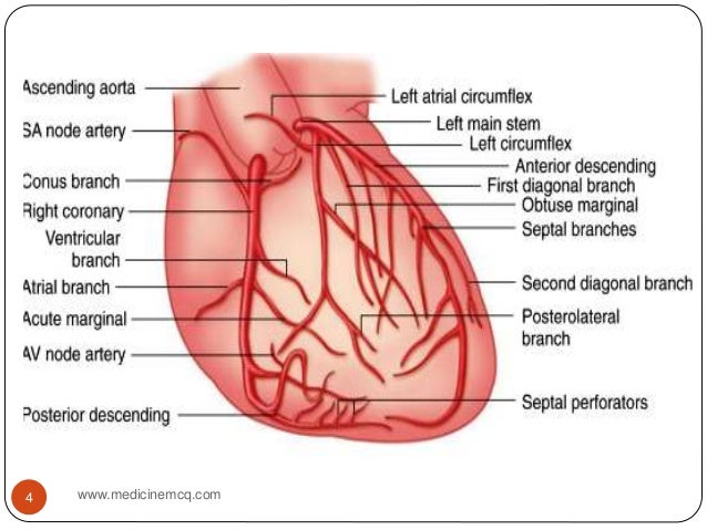 ramus coronary artery diagram