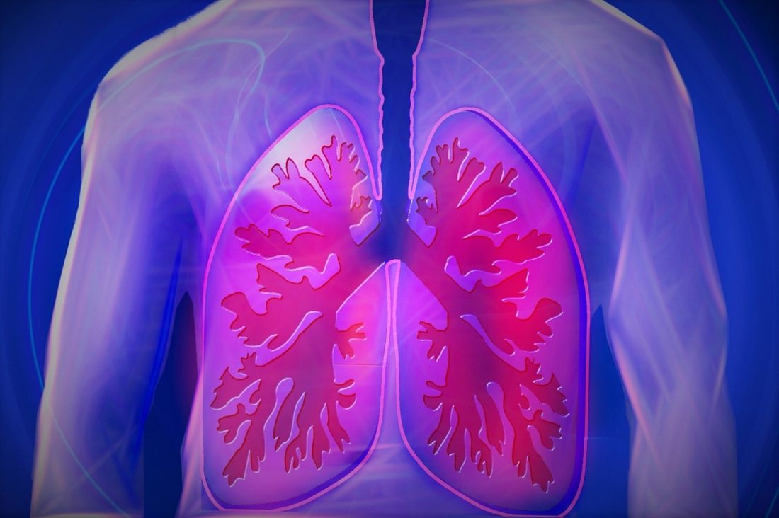 Lung Infection May Be Less Transmissible Than Thought - Science in Boston