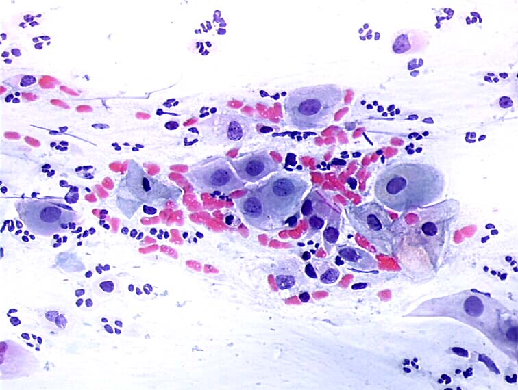 Cytopathology Of The Uterine Cervix Digital Atlas