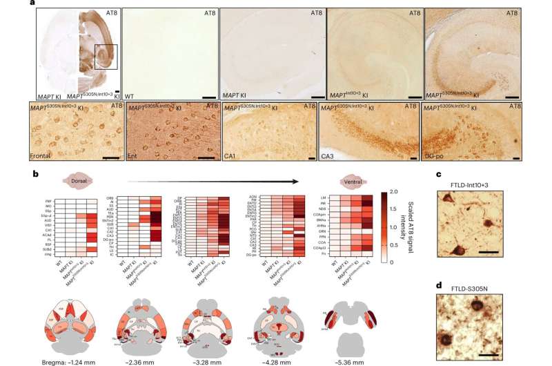 Study hints at the role of tau hyperphosphorylation in the early stages of neurodegenerative diseases