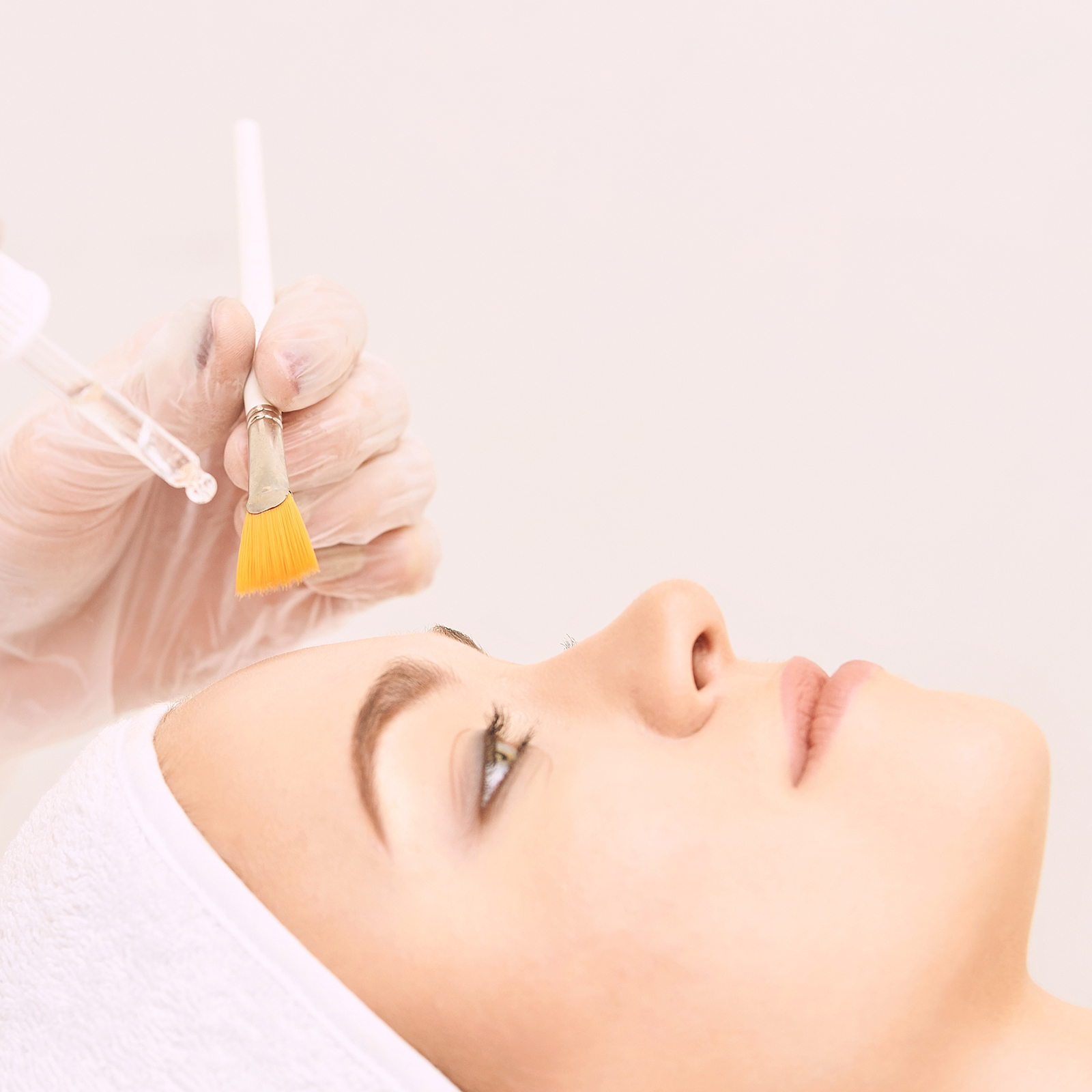 PCA Chemical Peel