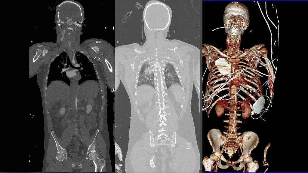 Emergency Trauma Radiology: Past, Present and Future - ppt download