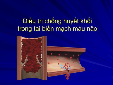 Điều trị chống huyết khối trong tai biến mạch máu não