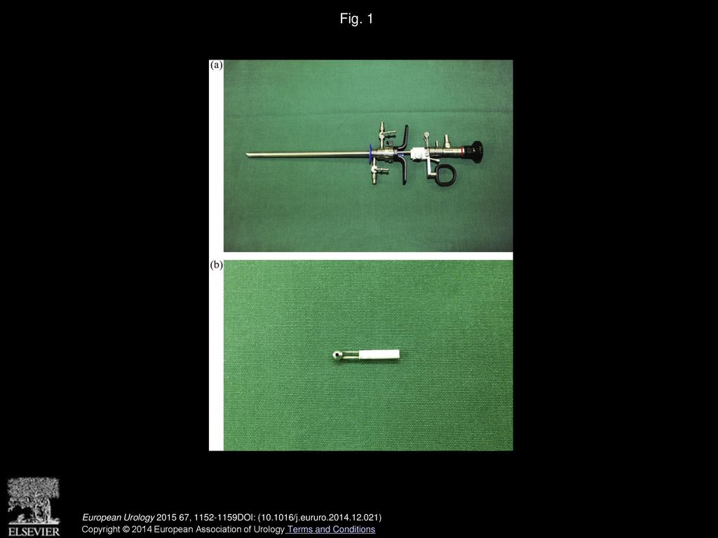 Photoselective Vaporesection of the Prostate with a Front-firing ...