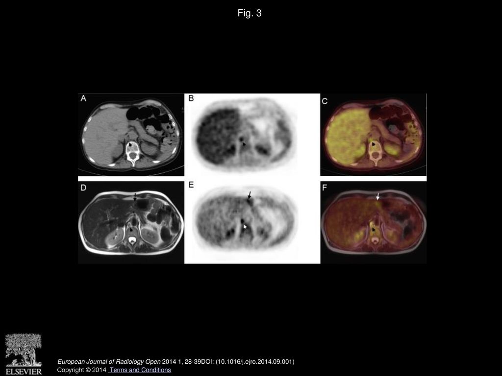 MR-PET of the body: Early experience and insights - ppt download