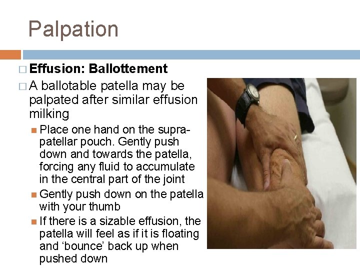 Palpation � Effusion: Ballottement � A ballotable patella may be palpated after similar effusion