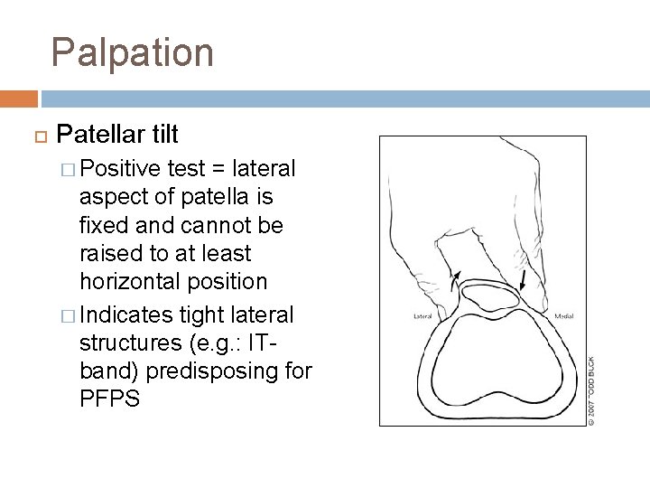 Palpation Patellar tilt � Positive test = lateral aspect of patella is fixed and