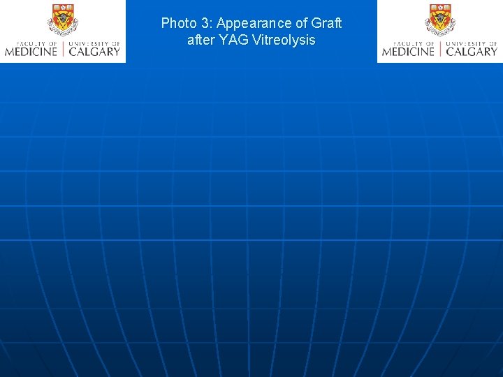 Photo 3: Appearance of Graft after YAG Vitreolysis 