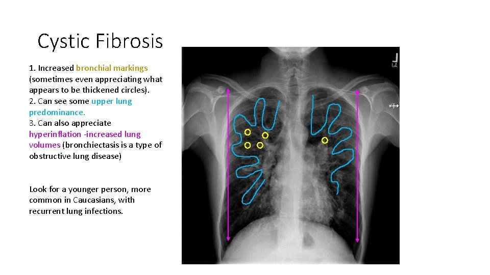 Welcome to Chest Imaging Jeannie Kochkodan Dr Perry