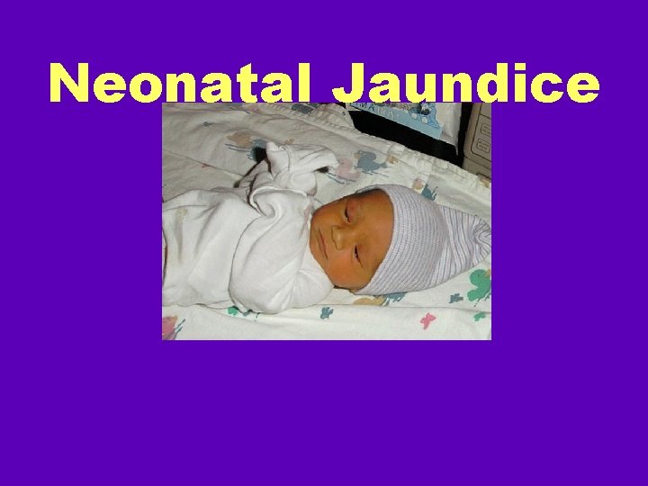 Neonatal Jaundice Neonatal Jaundice Learning Objectives Define ...