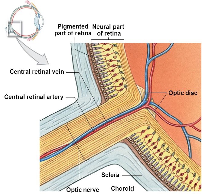 Retinal Vascular Disorders - Sydney Ophthalmic Specialists