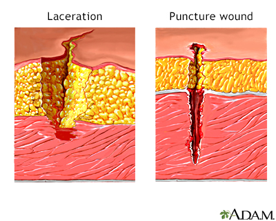 Deep Skin Cut