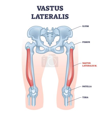 Illustration for Vastus lateralis muscle location and hip or leg skeletal bone outline diagram. Labeled educational human hip scheme with anatomical ilium, femur, patella and tibia body parts vector illustration. - Royalty Free Image