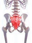 Focus of inflammation localized in sacrum — Stock Photo