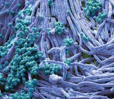 Coloured scanning electron micrograph of bacteria cultured from mobile phone. — Stock Photo