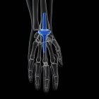 Illustration of wrist replacement on black background. — Stock Photo