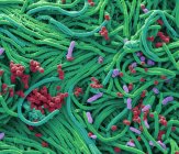 Coloured scanning electron micrograph of bacteria cultured from mobile phone surface. — Stock Photo