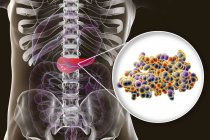 Pancreas in human body and close-up view of insulin molecule, digital illustration. — Stock Photo