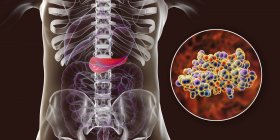 Pancreas in human body and close-up view of insulin molecule, digital illustration. — Stock Photo