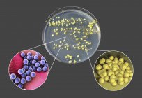 Bacterial culture grown from human skin on Petri dish with nutrient medium. — Stock Photo