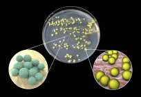 Bacterial culture grown from human skin on Petri dish with nutrient medium. — Stock Photo