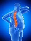 Obese male body with back pain, digital illustration. — Stock Photo