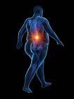 Walking obese male silhouette with visible back pain, digital illustration. — Stock Photo