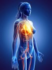 Heart disease in female body, conceptual digital illustration. — Stock Photo