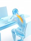 Stressed office worker with back pain, conceptual illustration. — Stock Photo