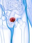 Diseased bladder in abstract human body, conceptual digital illustration. — Stock Photo