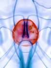 Diseased bladder in abstract human body, conceptual digital illustration. — Stock Photo