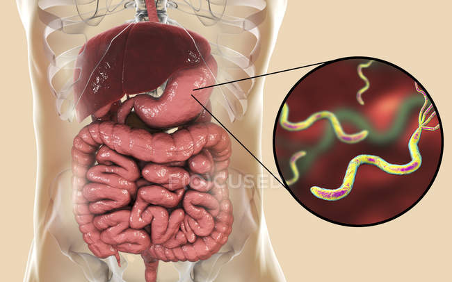 Digital illustration of Helicobacter pylori bacteria in human stomach. — Stock Photo