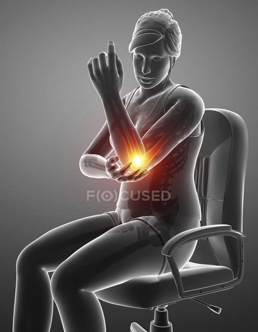 Sitting in chair female silhouette with elbow pain, digital illustration. — Stock Photo