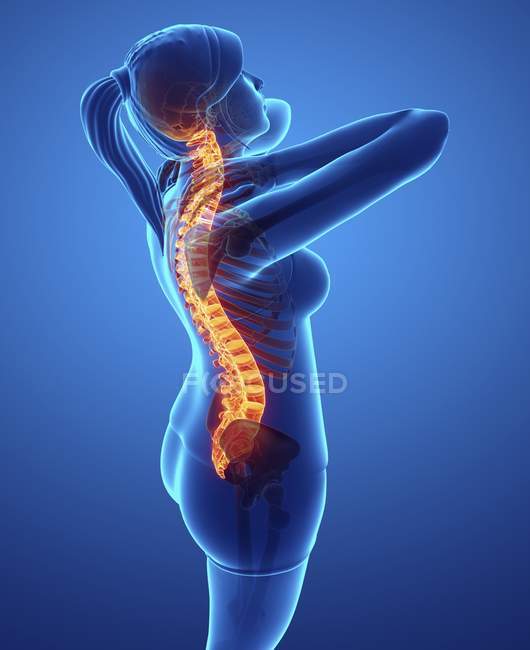 Female silhouette with back pain, digital illustration. — Stock Photo