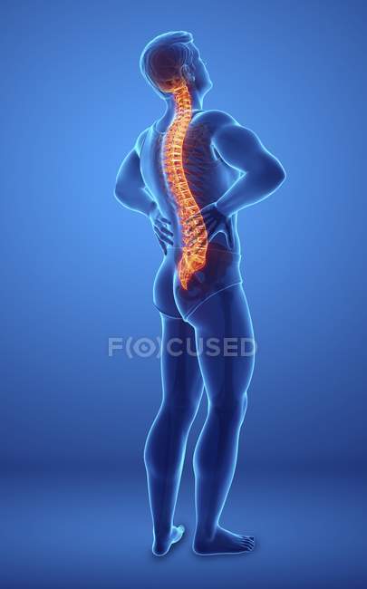 Male silhouette with back pain, digital illustration. — Stock Photo