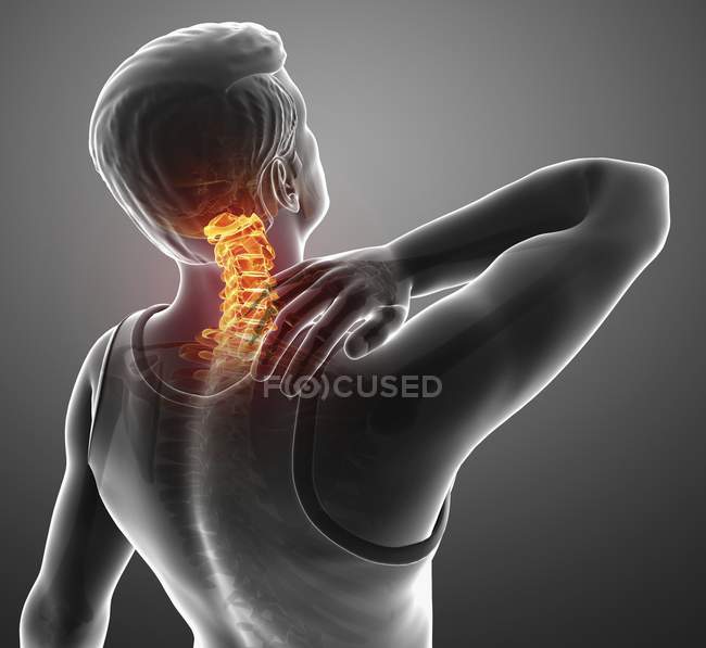 Male silhouette with back pain, digital illustration. — Stock Photo