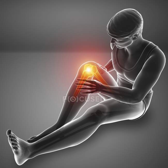 Sitting male silhouette with knee pain, digital illustration. — Stock Photo